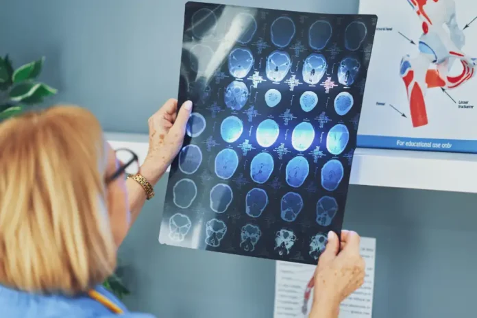 Glioblastoma anticorpi