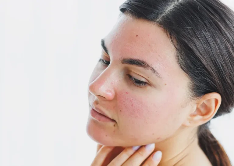 laser dermatologico
