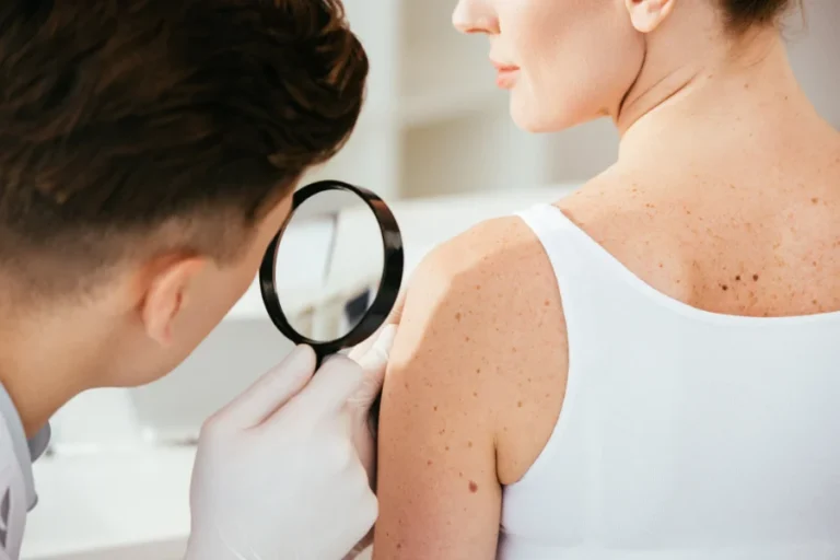 Melanoma Liguria visite