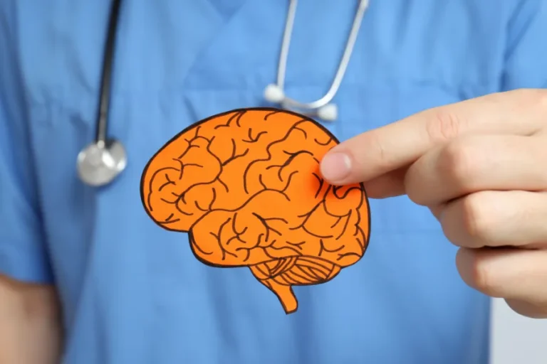 Alzheimer cervello