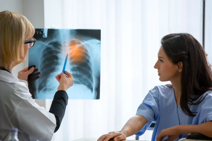 Cancro polmone
