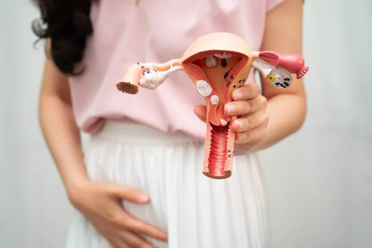 Endometriosi