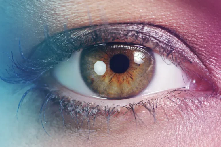 Glaucoma: a Pordenone arriva la chirurgia mini-invasiva con micro-stent di ultima generazione