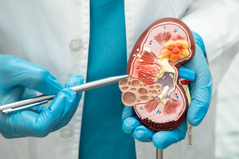 Malattia renale cronica: una patologia sistemica che coinvolge anche il sistema nervoso