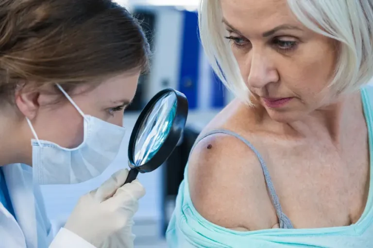 Melanoma vestiti pelle