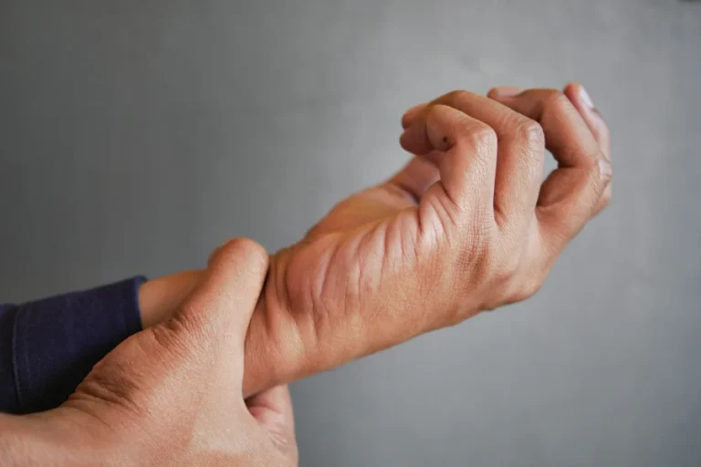 Sindrome De Quervain Dott. Merello