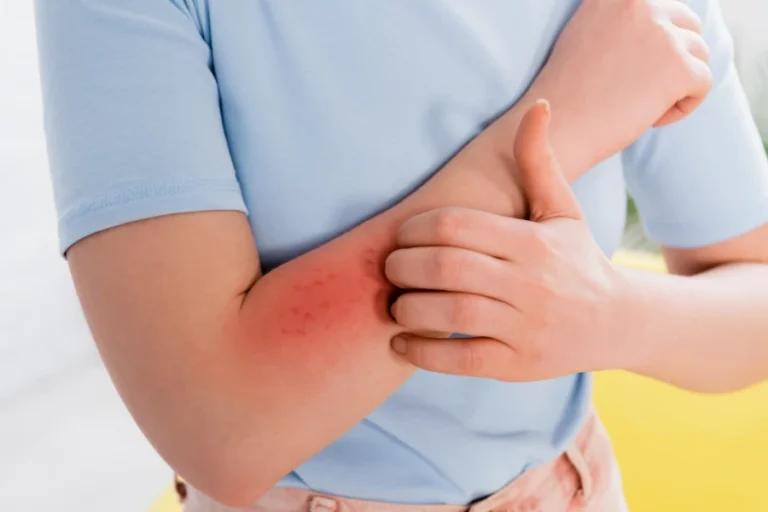 prurito dermatologia