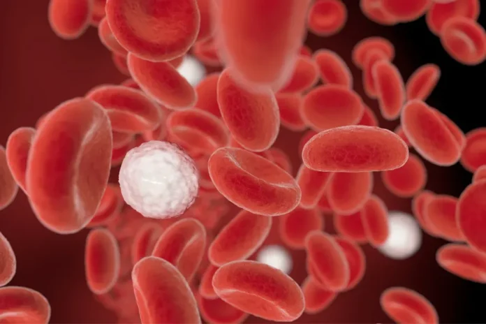Leucemia