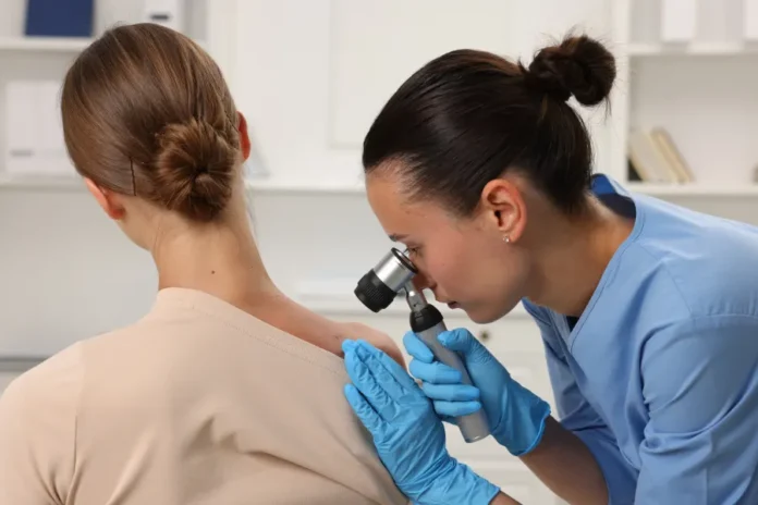 Melanoma