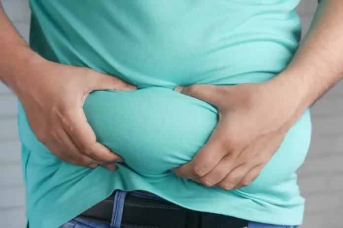 Obesità