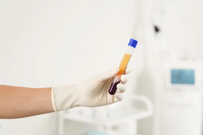 Plasma sangue Italia