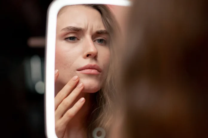 Acne farmaci Dott.ssa Romagnoli