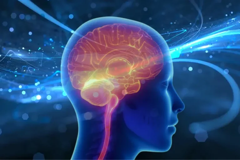 Cervello Alzheimer