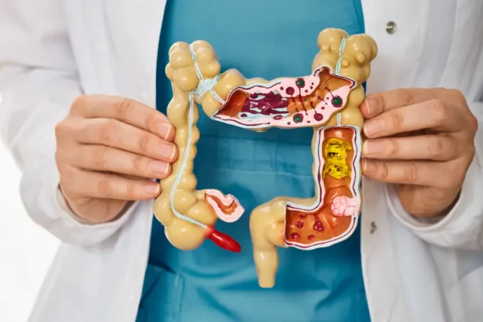 Colon irritabile intestino Prof. Sukkar
