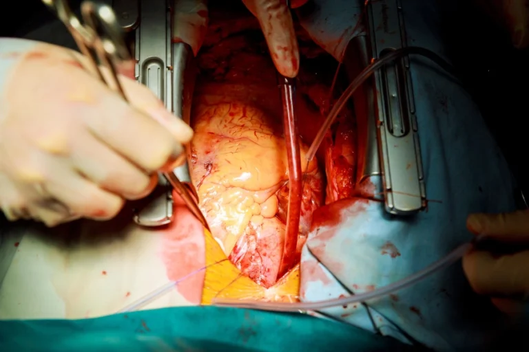 cardiologia